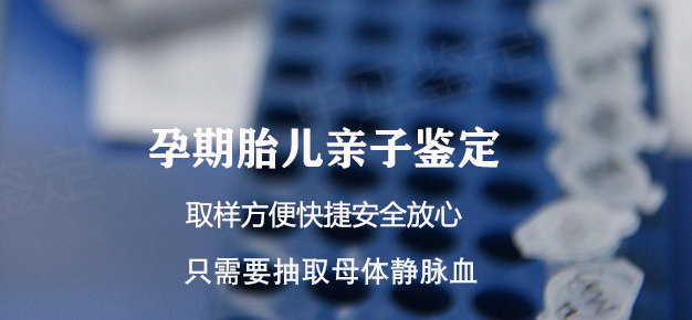 在[河南]刚怀孕如何办理DNA亲子鉴定,河南孕期亲子鉴定大概价格